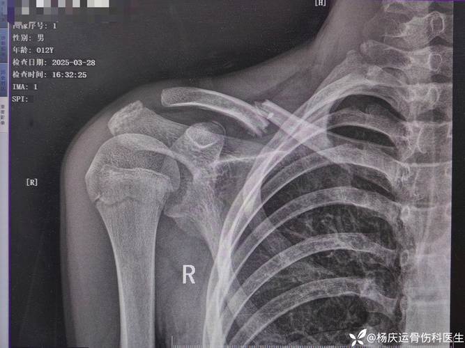 2025新澳门正版免费正题175和被狗主人殴打致骨折与狗被打骨折了怎么办