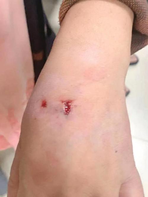 新奥今晚买什么和狗闯村民家咬伤女童与村里的狗咬人,应该找谁解决